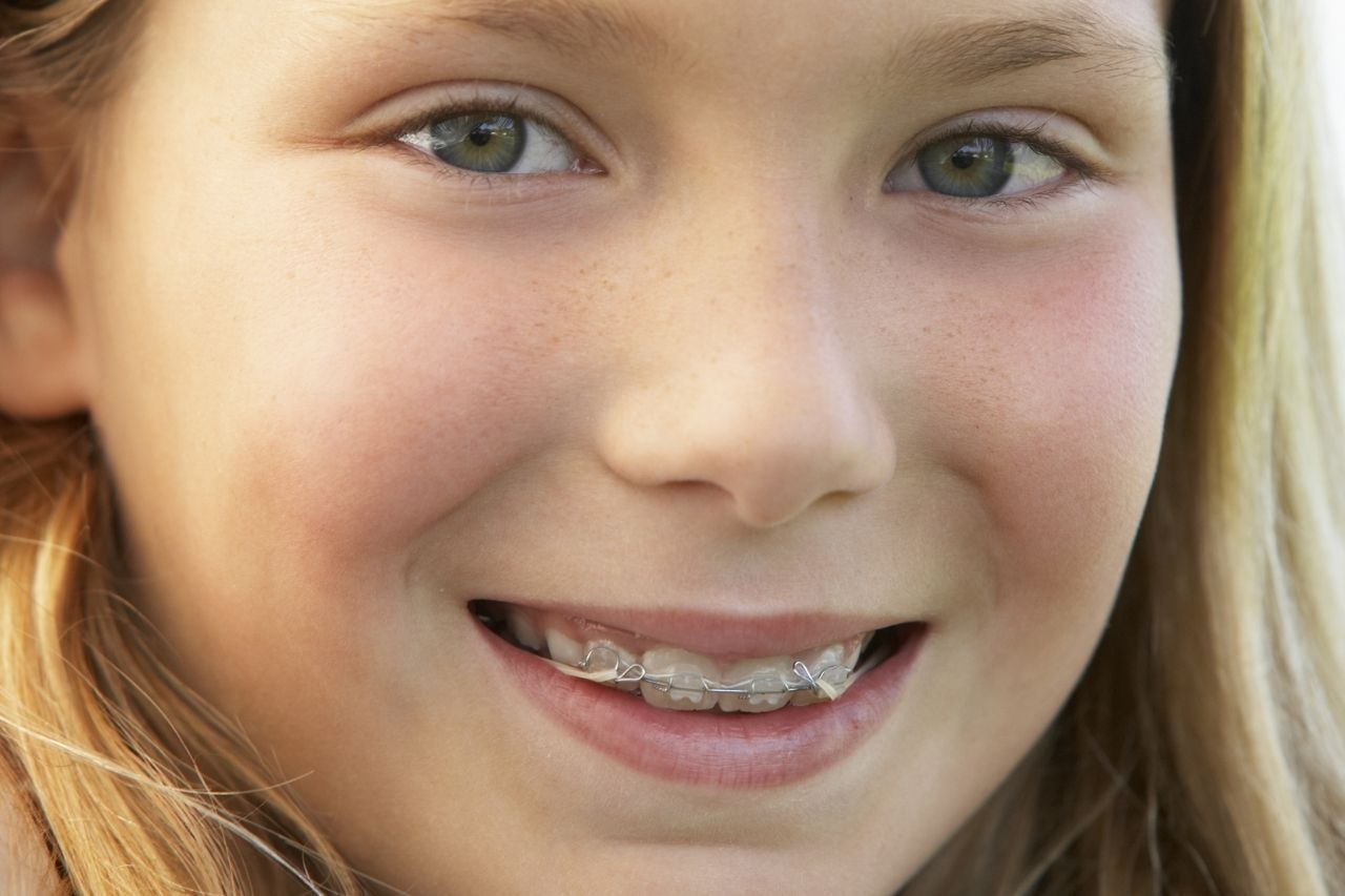 ortodoncia infantil y su primer mes consejos para los niños